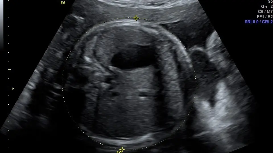 Imagen Presentación